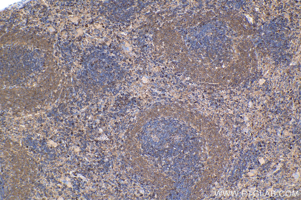 Immunohistochemical analysis of paraffin-embedded rat spleen tissue slide using KHC1357 (BLNK IHC Kit).