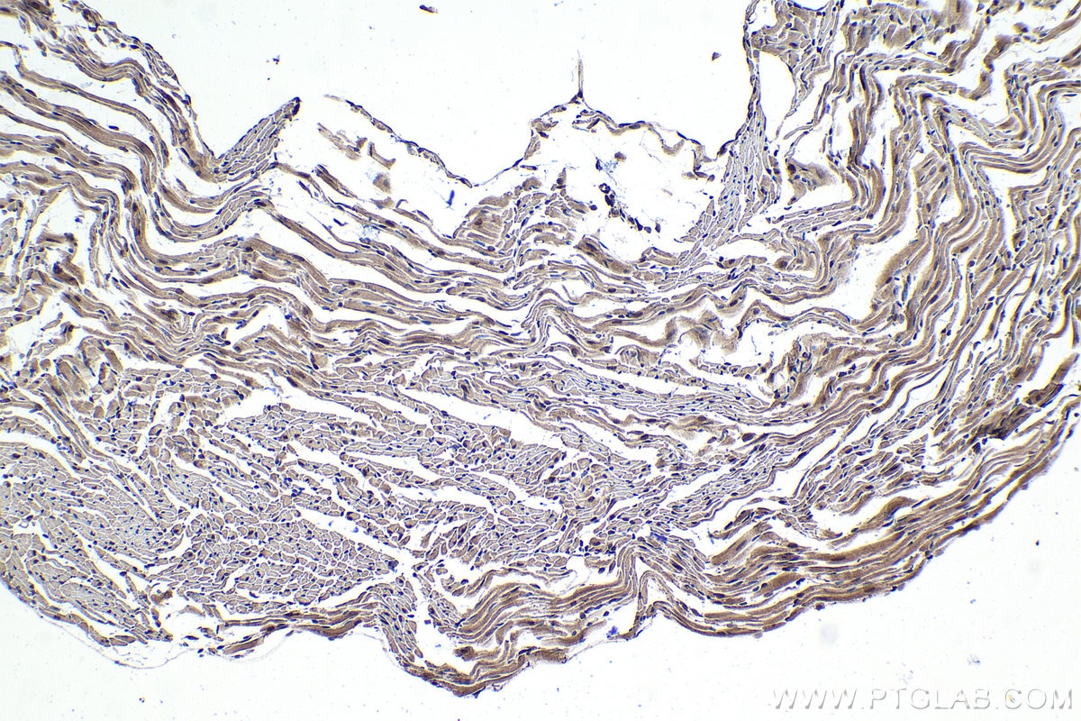 Immunohistochemical analysis of paraffin-embedded mouse heart tissue slide using KHC1421 (BMAL1/ARNTL IHC Kit).