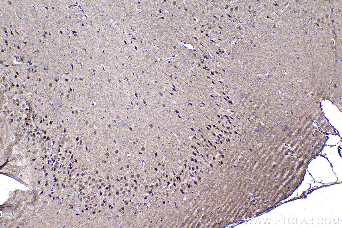 Immunohistochemical analysis of paraffin-embedded rat brain tissue slide using KHC1421 (BMAL1/ARNTL IHC Kit).