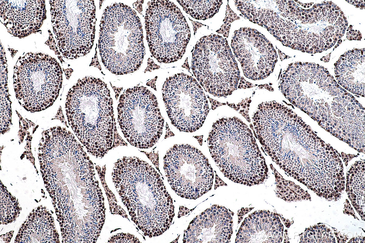 Immunohistochemical analysis of paraffin-embedded mouse testis tissue slide using KHC0296 (BMI1 IHC Kit).