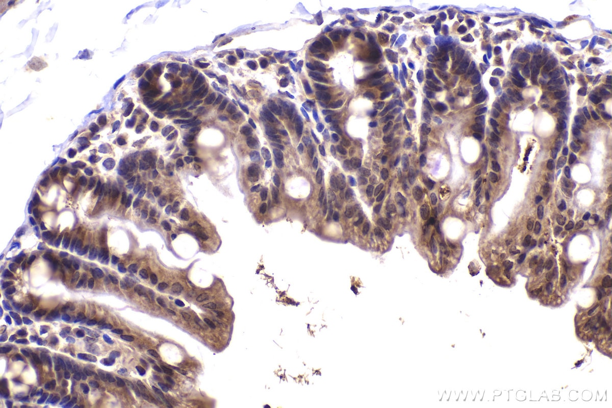 Immunohistochemical analysis of paraffin-embedded mouse intestine tissue slide using KHC2183 (BMP4 IHC Kit).