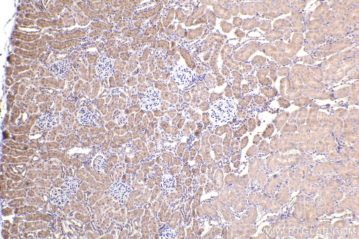 Immunohistochemical analysis of paraffin-embedded rat kidney tissue slide using KHC2413 (BNIP2 IHC Kit).