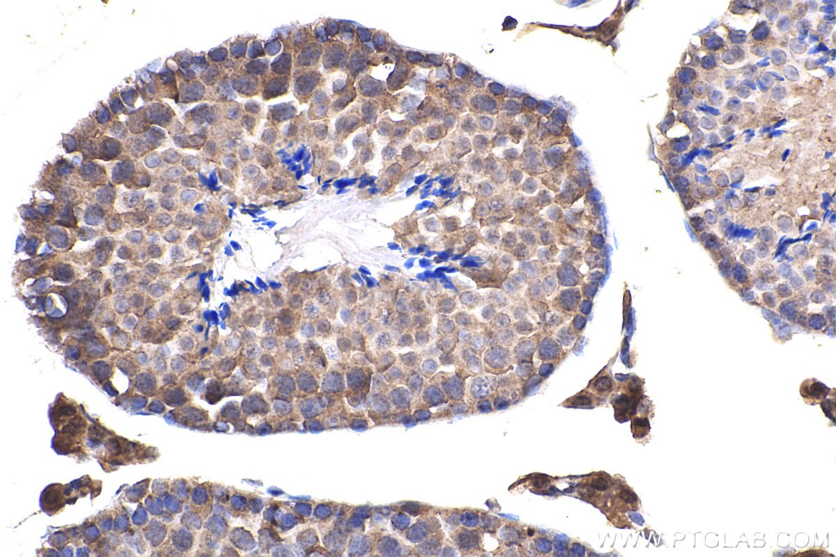 Immunohistochemical analysis of paraffin-embedded mouse testis tissue slide using KHC2381 (BORG5/CDC42EP1 IHC Kit).