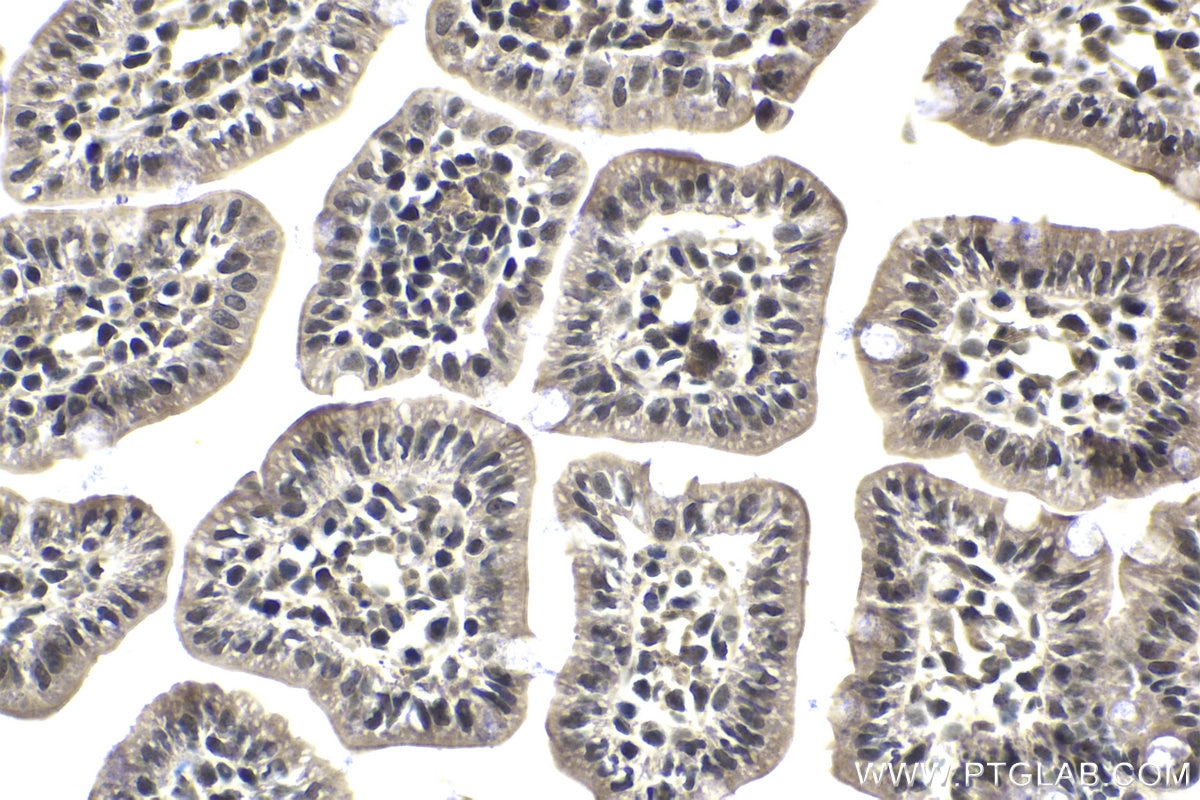 Immunohistochemical analysis of paraffin-embedded mouse small intestine tissue slide using KHC1692 (BPTF IHC Kit).