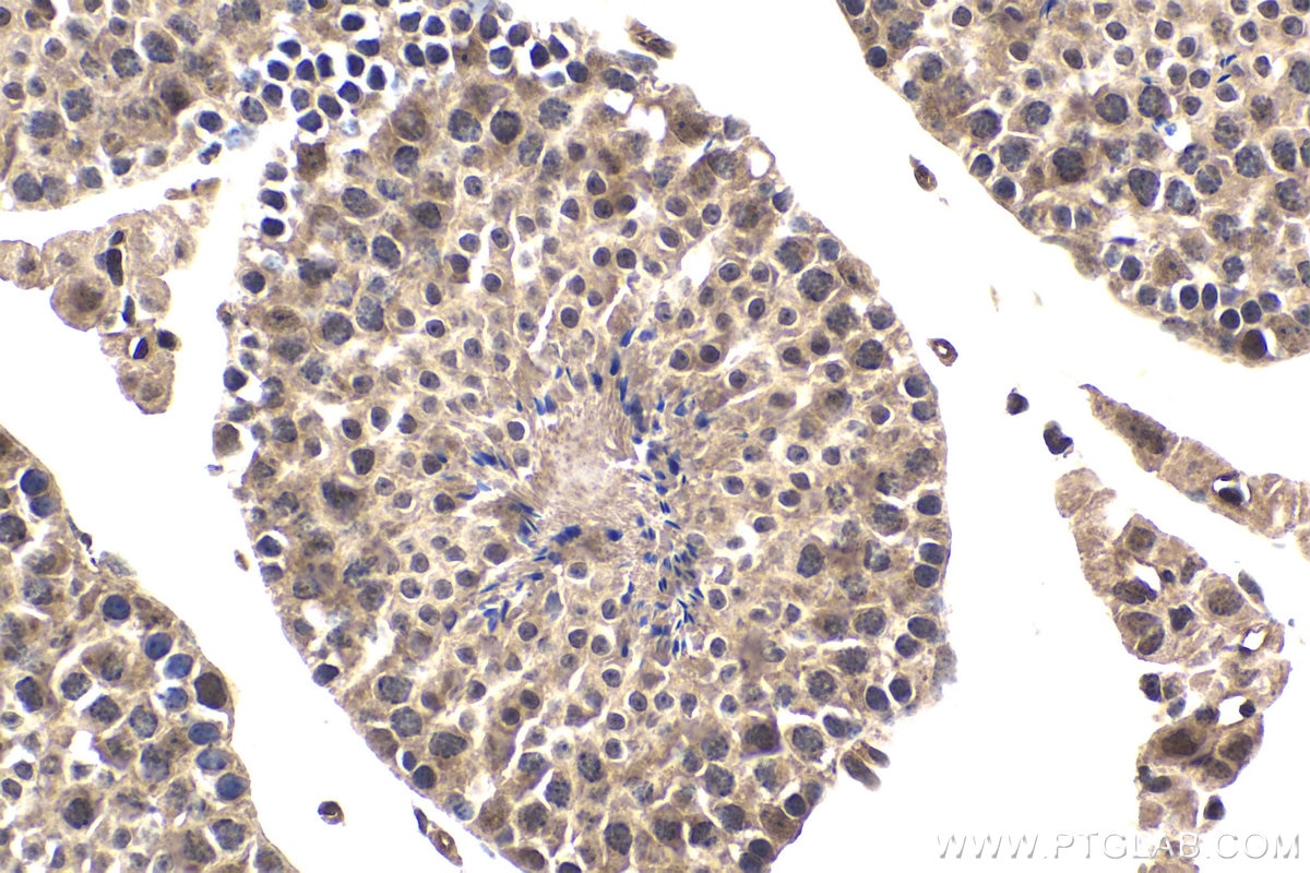 Immunohistochemical analysis of paraffin-embedded mouse testis tissue slide using KHC1692 (BPTF IHC Kit).