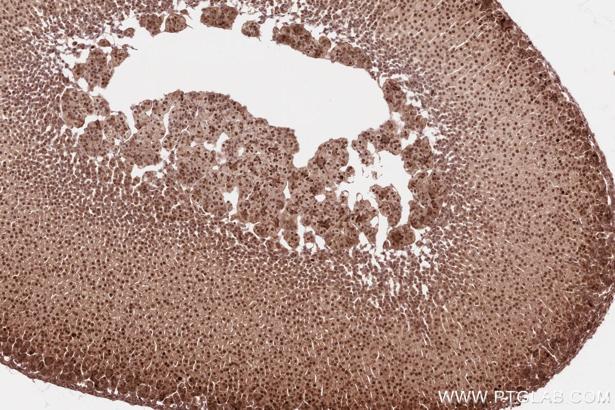 Immunohistochemical analysis of paraffin-embedded mouse adrenal gland tissue slide using KHC2592 (BRAT1 IHC Kit).
