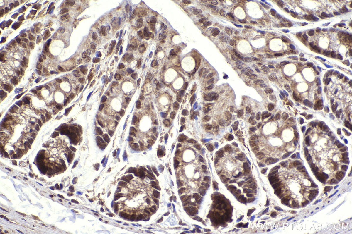 Immunohistochemical analysis of paraffin-embedded mouse colon tissue slide using KHC2278 (BRCC3 IHC Kit).