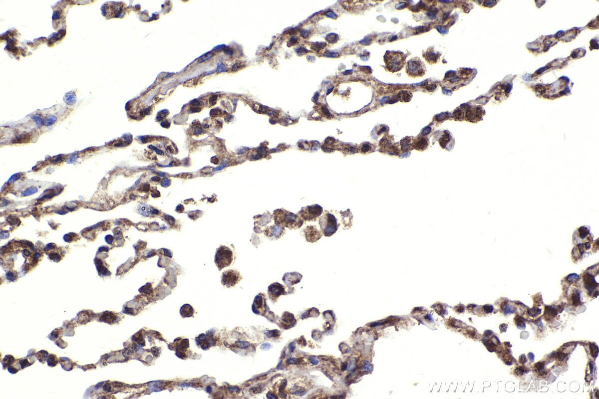 Immunohistochemical analysis of paraffin-embedded human lung tissue slide using KHC2278 (BRCC3 IHC Kit).