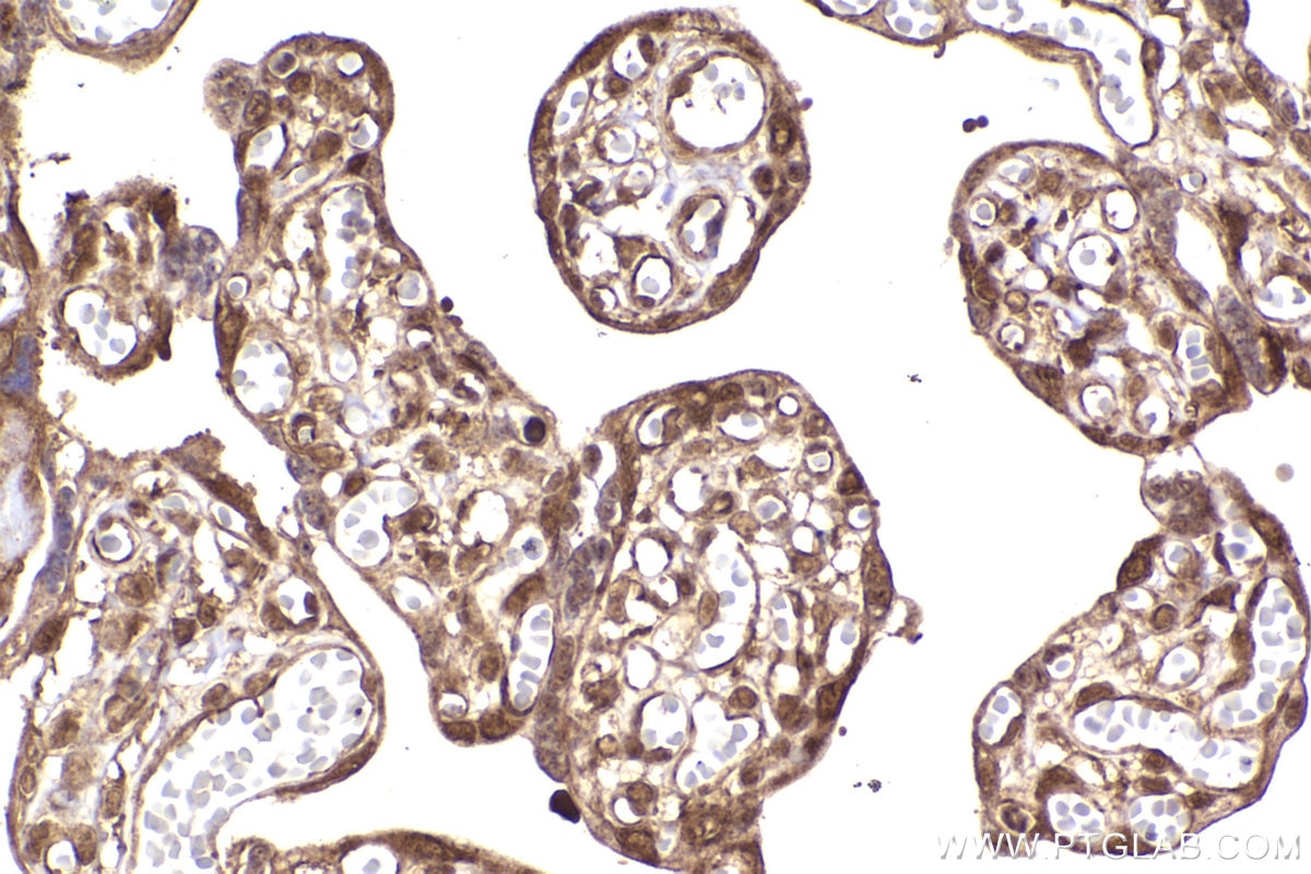Immunohistochemical analysis of paraffin-embedded human placenta tissue slide using KHC2278 (BRCC3 IHC Kit).