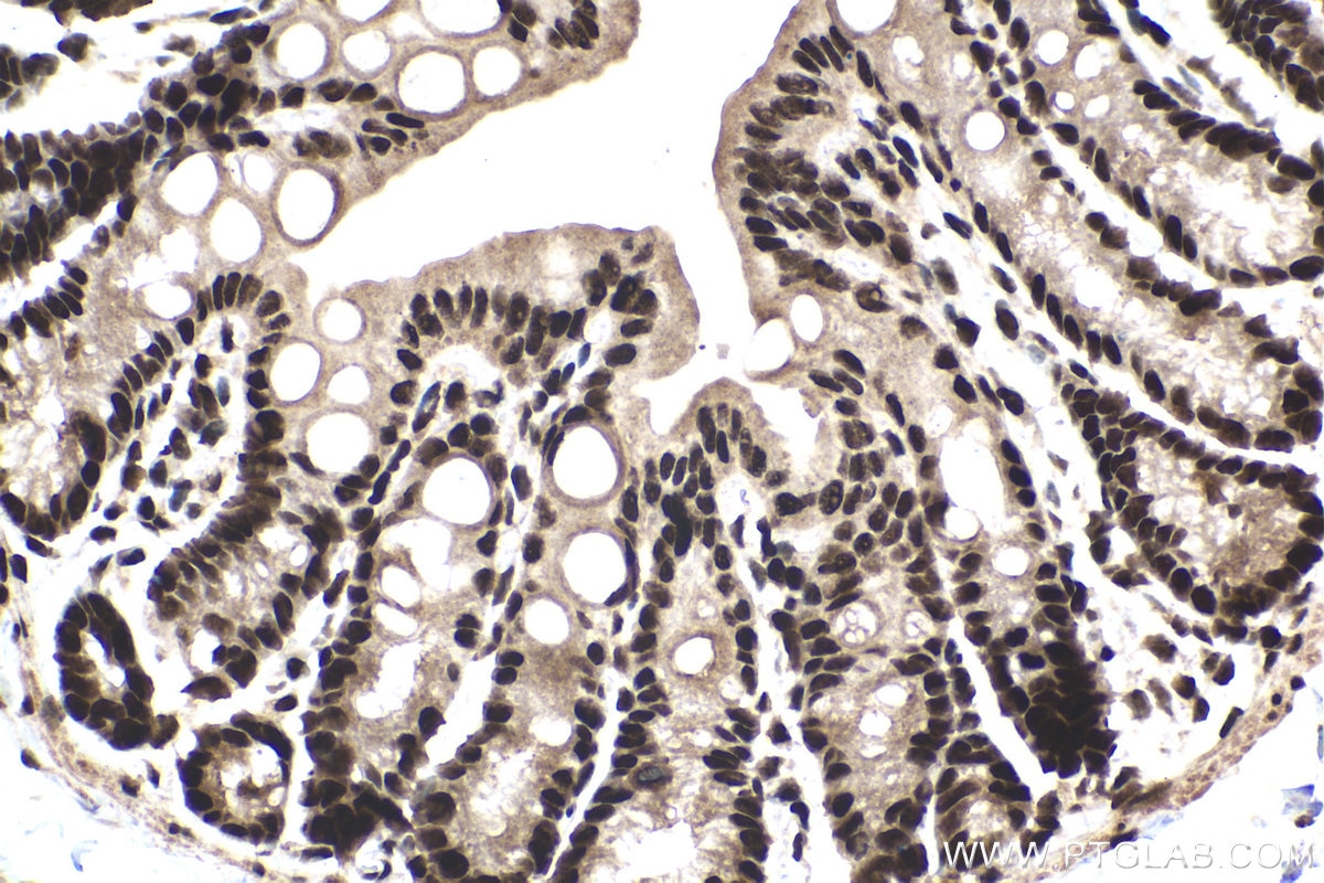 Immunohistochemical analysis of paraffin-embedded mouse colon tissue slide using KHC1470 (BRD4 IHC Kit).