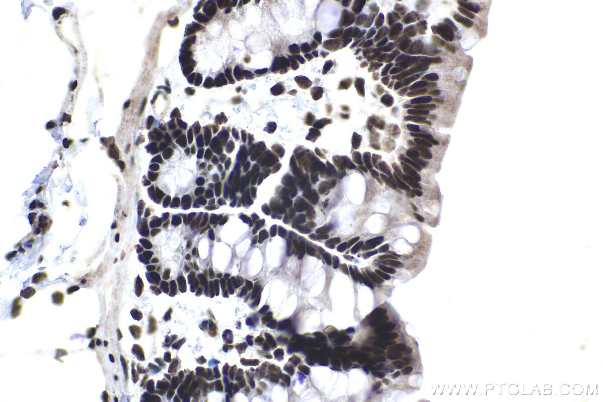 Immunohistochemical analysis of paraffin-embedded rat colon tissue slide using KHC1470 (BRD4 IHC Kit).