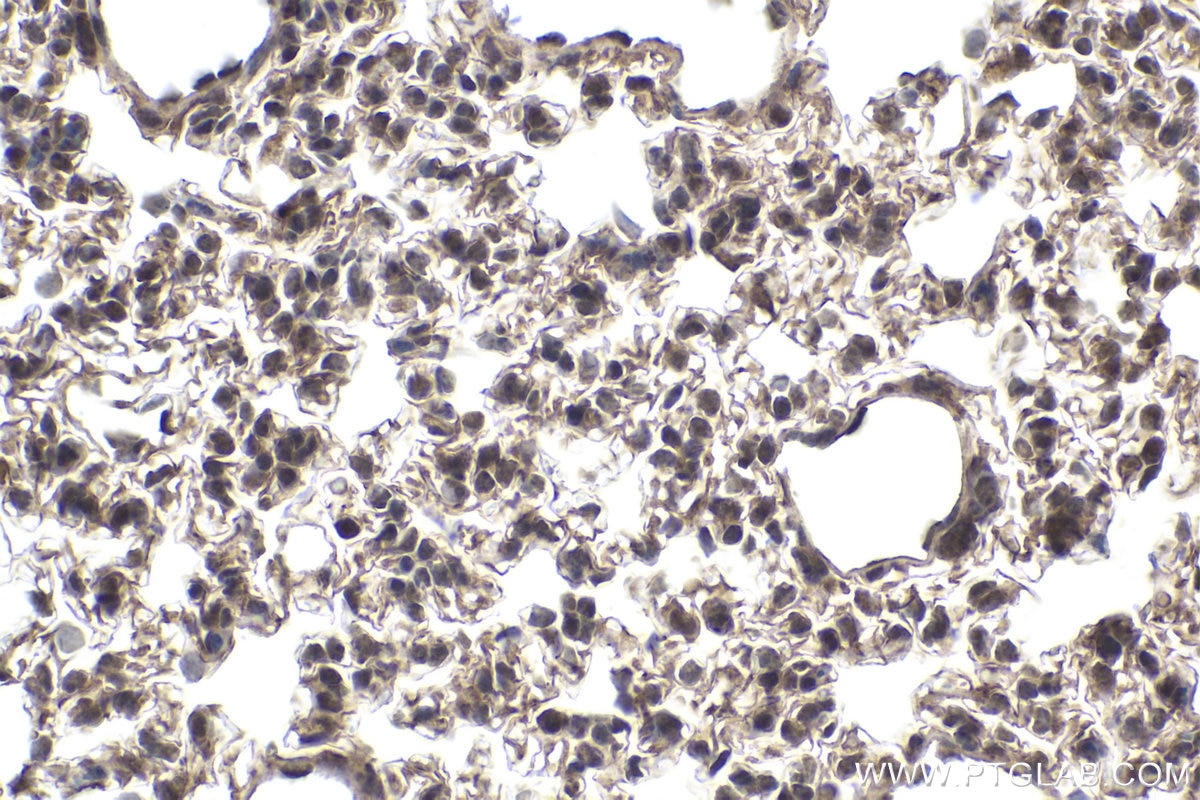 Immunohistochemical analysis of paraffin-embedded mouse lung tissue slide using KHC1955 (BRD7 IHC Kit).