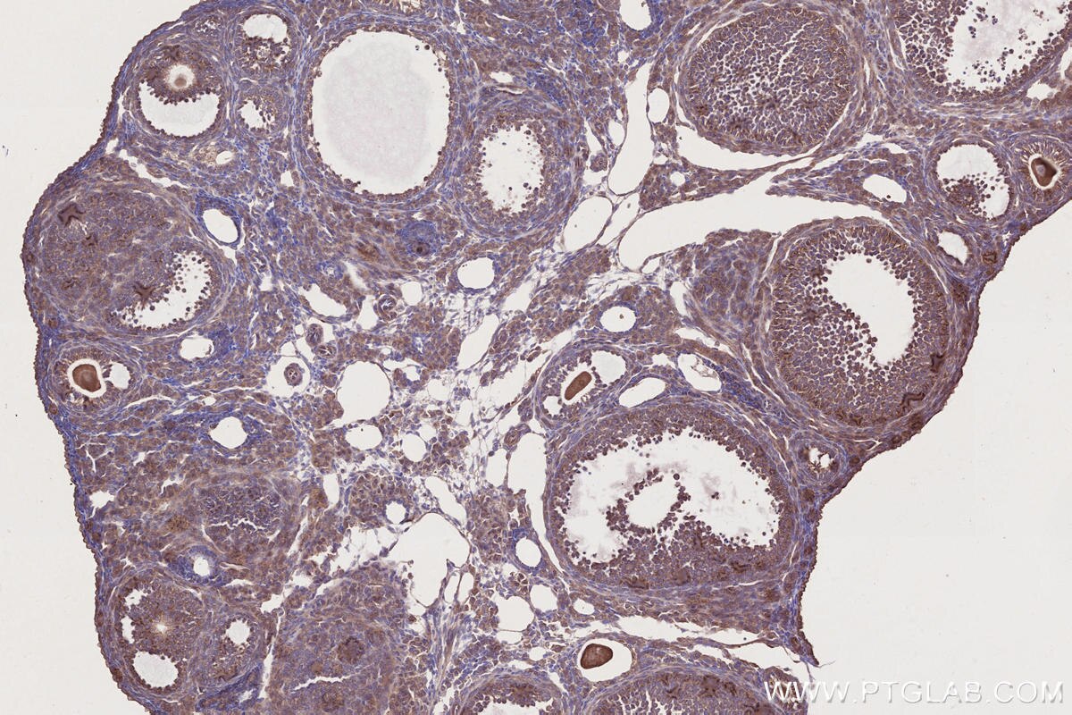 Immunohistochemical analysis of paraffin-embedded mouse ovary tissue slide using KHC2733 (BRK1/C3orf10 IHC Kit).