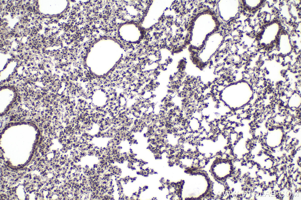 Immunohistochemical analysis of paraffin-embedded mouse lung tissue slide using KHC1949 (BRMS1 IHC Kit).