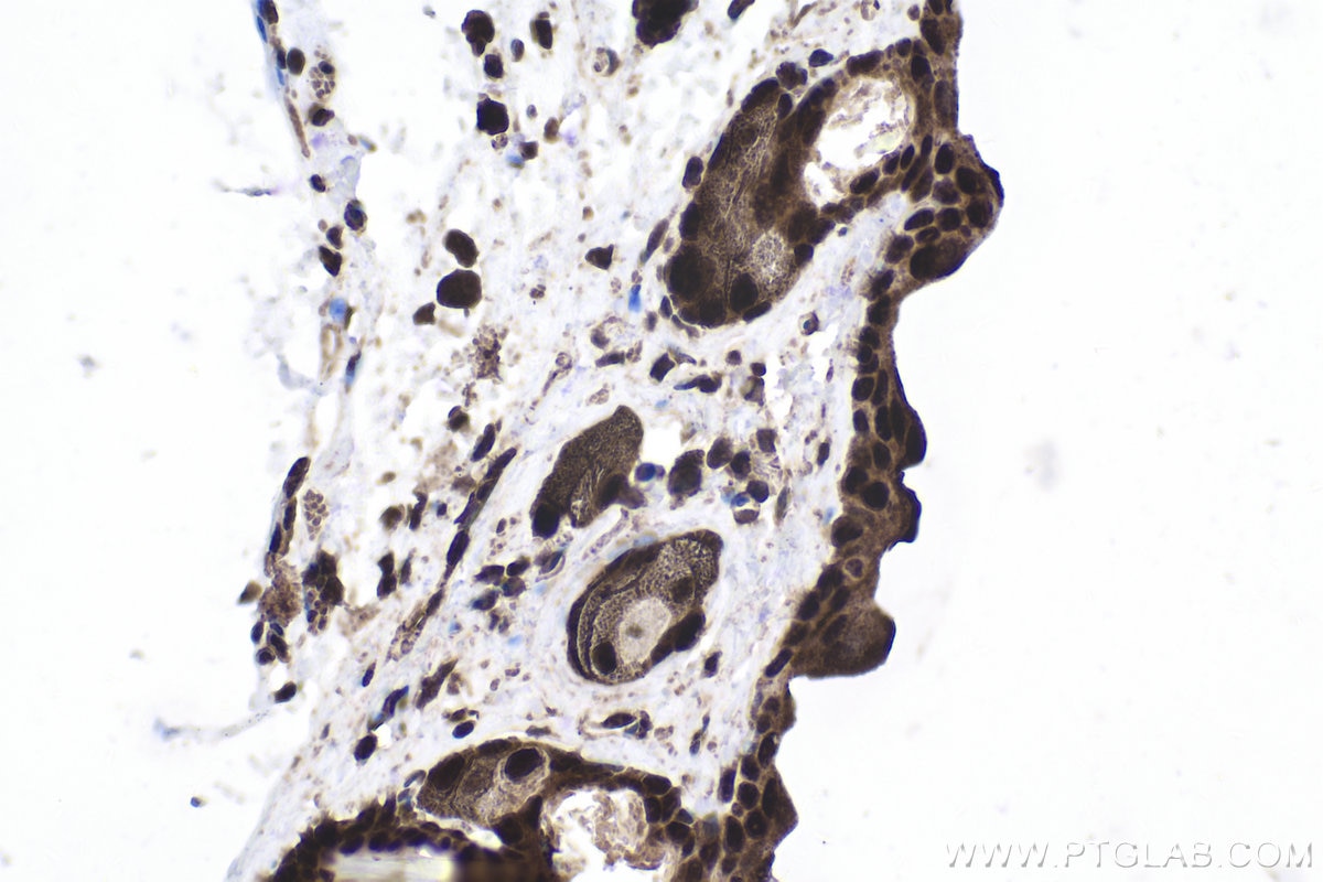 Immunohistochemical analysis of paraffin-embedded mouse skin tissue slide using KHC1949 (BRMS1 IHC Kit).