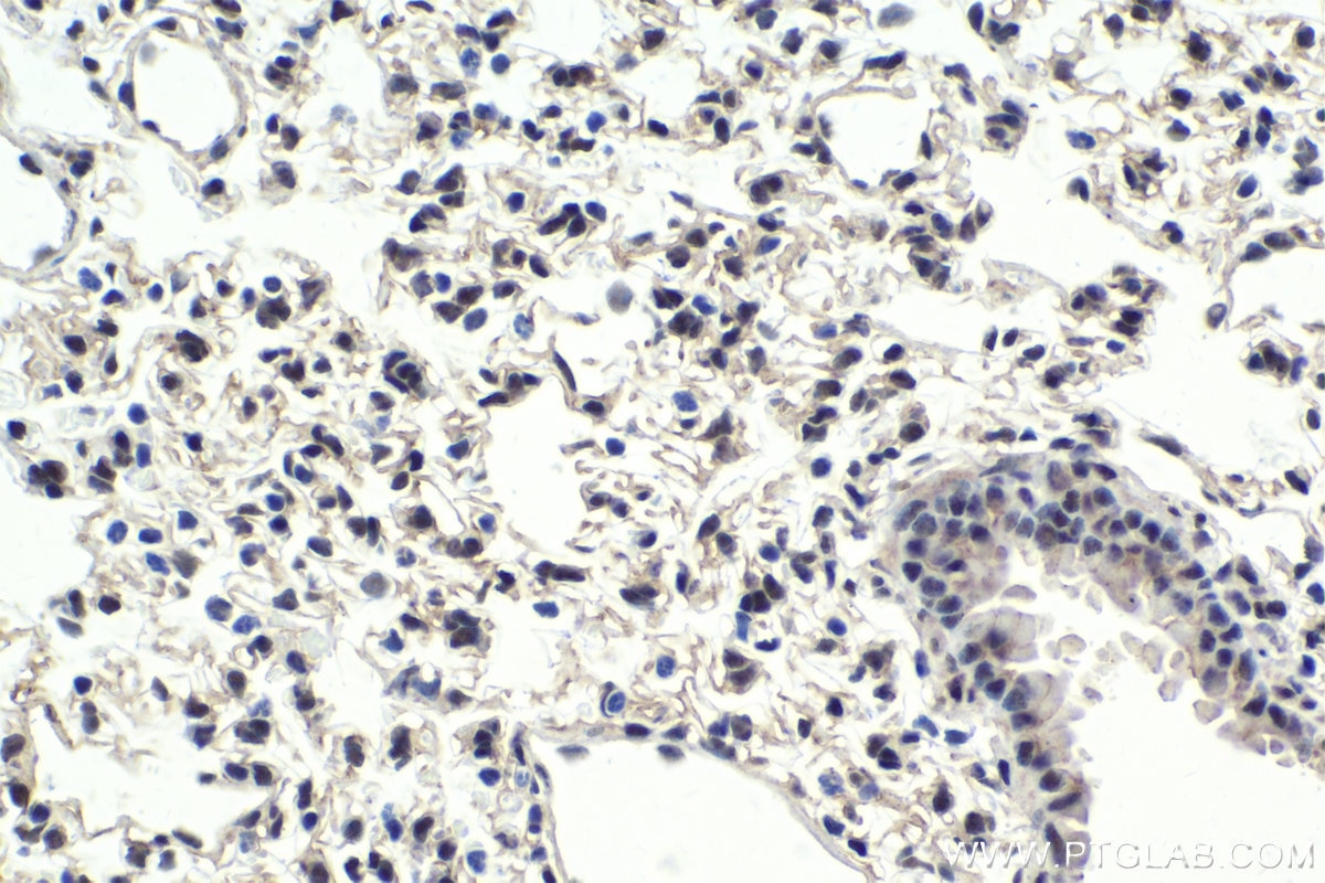 Immunohistochemical analysis of paraffin-embedded mouse lung tissue slide using KHC1777 (BRMS1L IHC Kit).