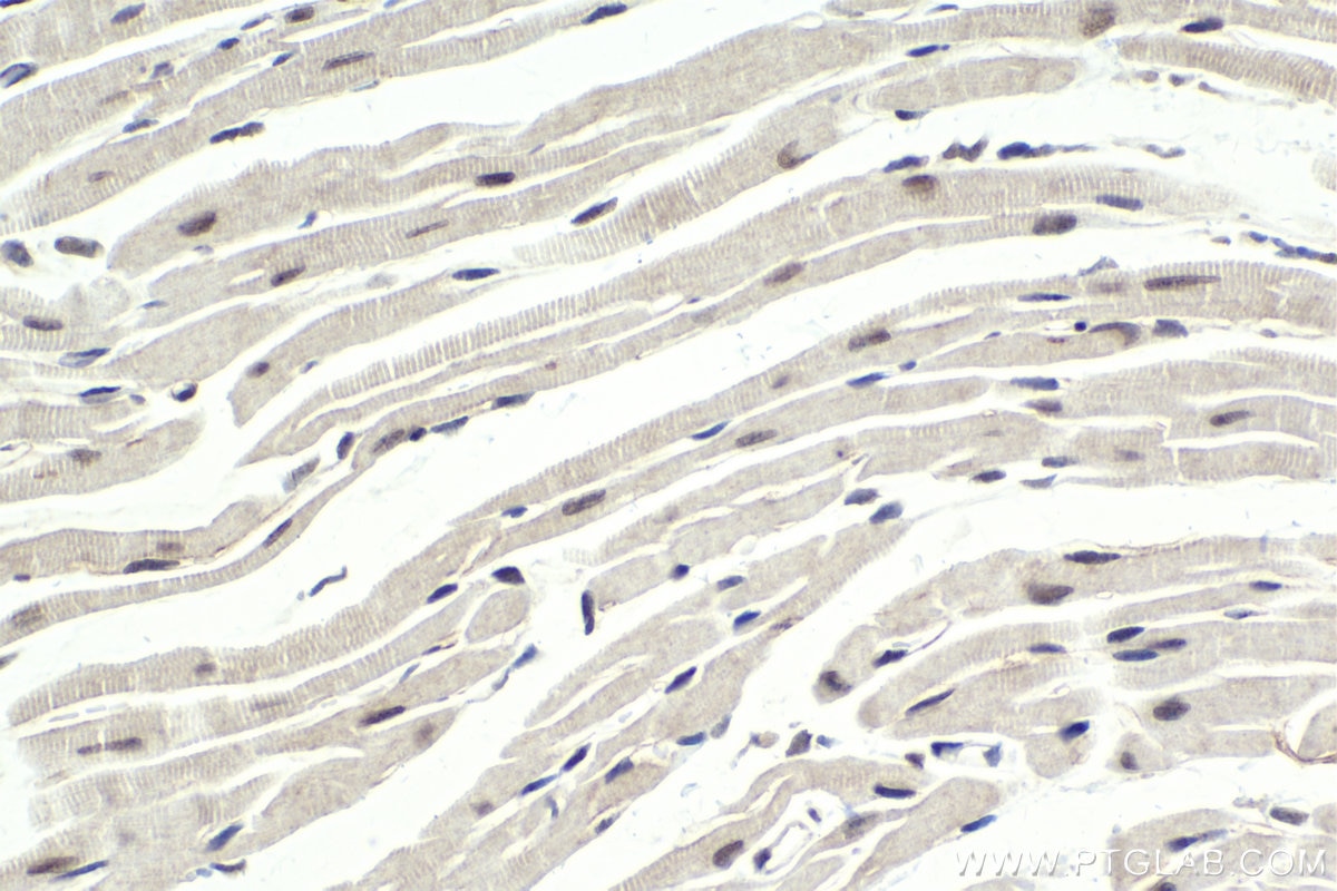 Immunohistochemical analysis of paraffin-embedded mouse heart tissue slide using KHC1777 (BRMS1L IHC Kit).