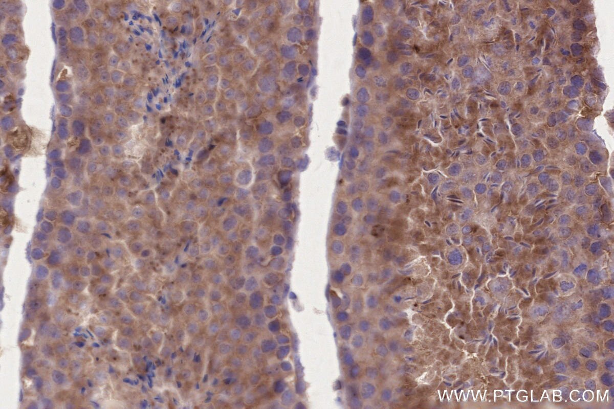 Immunohistochemical analysis of paraffin-embedded mouse testis tissue slide using KHC2652 (BRSK2 IHC Kit).