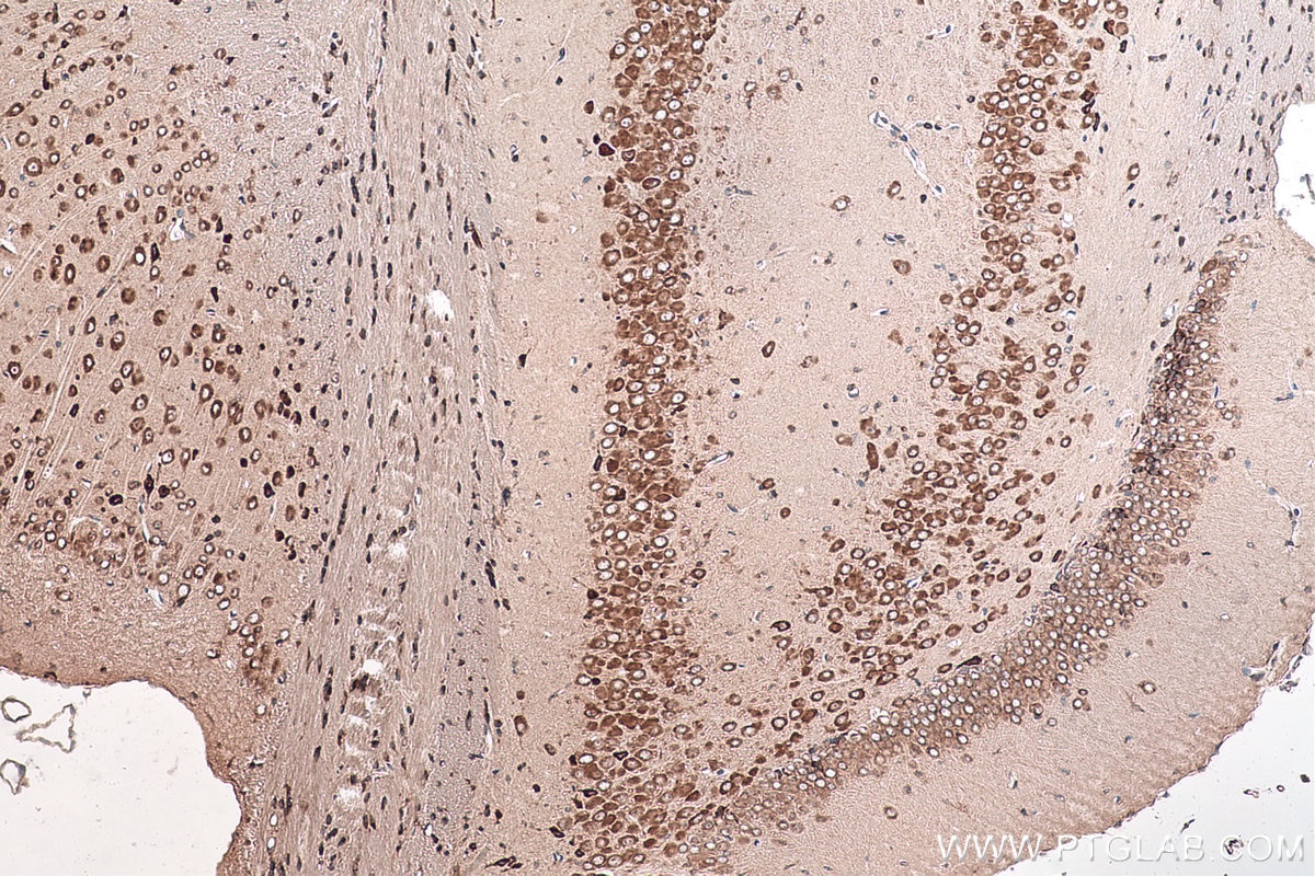 Immunohistochemical analysis of paraffin-embedded mouse brain tissue slide using KHC1009 (BTF3L4 IHC Kit).