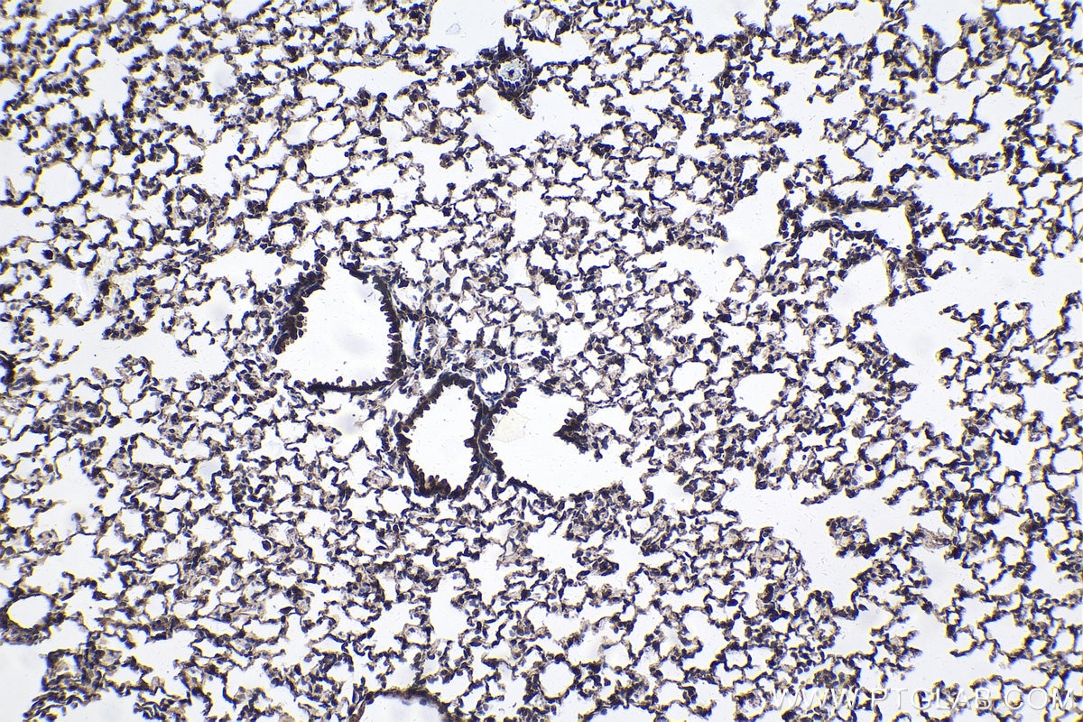 Immunohistochemical analysis of paraffin-embedded mouse lung tissue slide using KHC1677 (BTK IHC Kit).