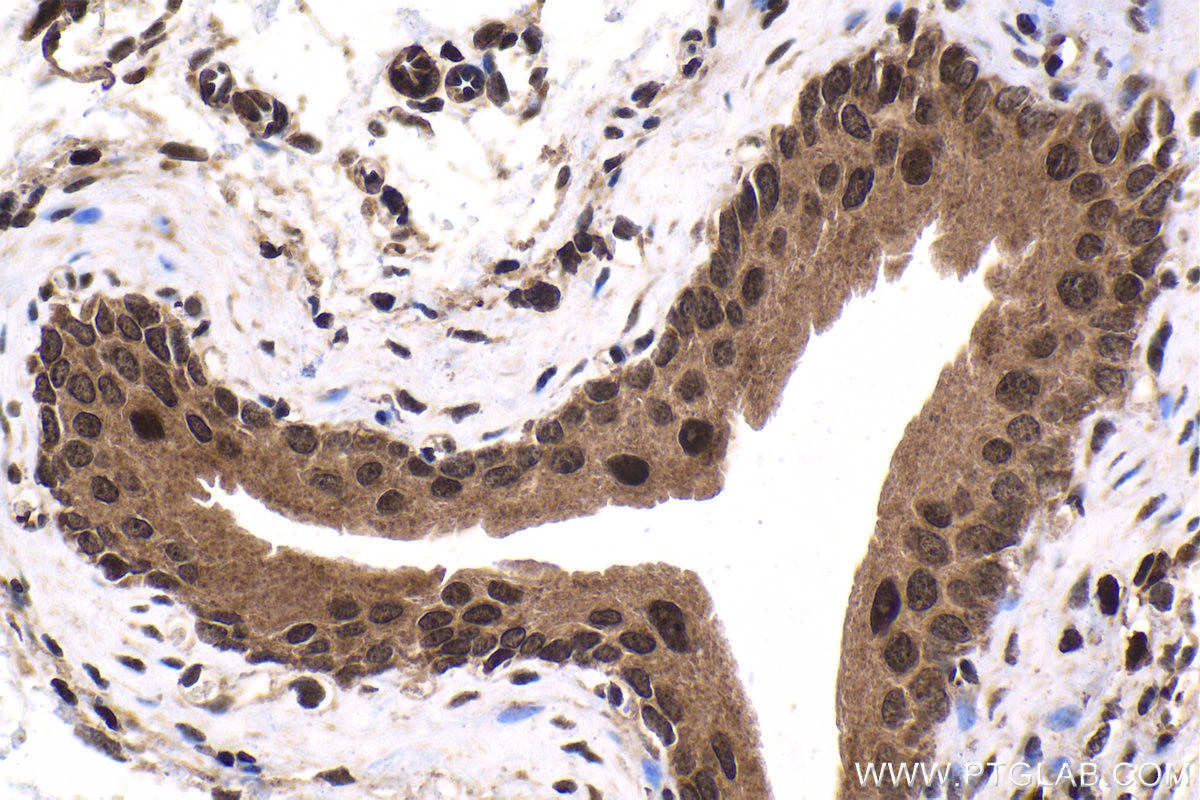 Immunohistochemical analysis of paraffin-embedded mouse bladder tissue slide using KHC1677 (BTK IHC Kit).