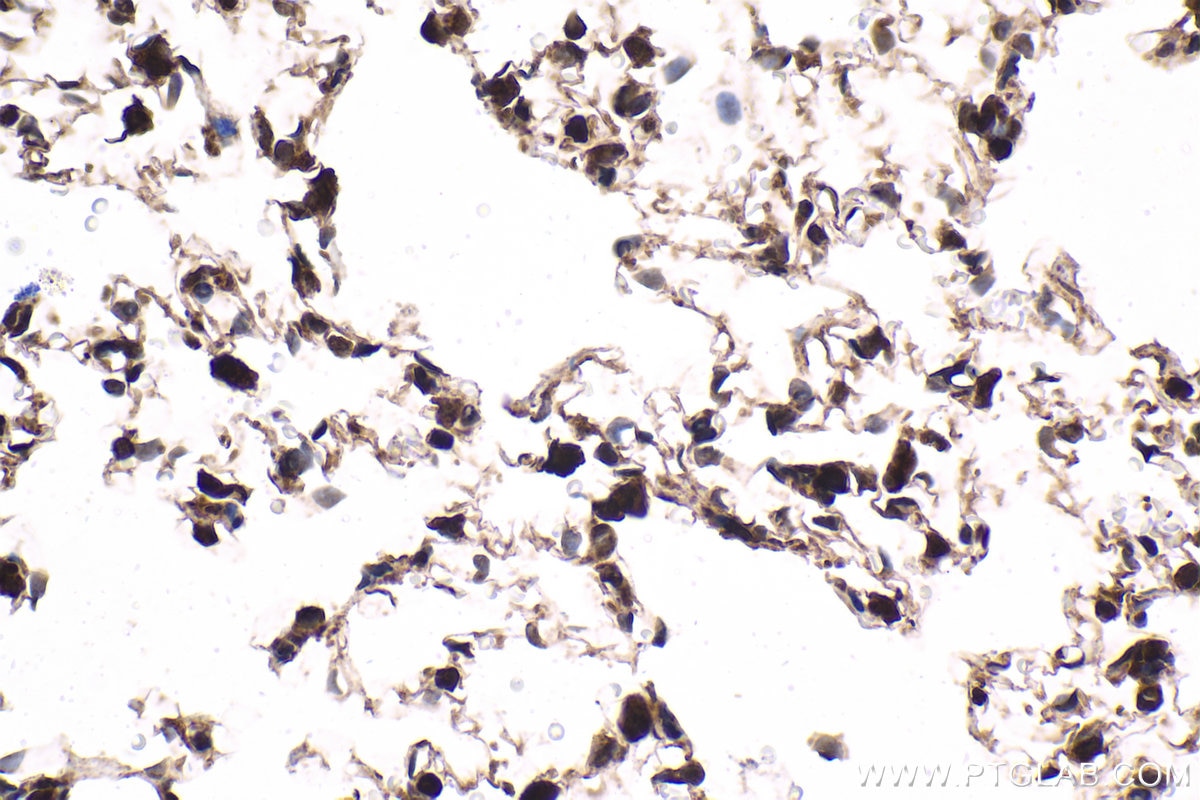 Immunohistochemical analysis of paraffin-embedded rat lung tissue slide using KHC1677 (BTK IHC Kit).