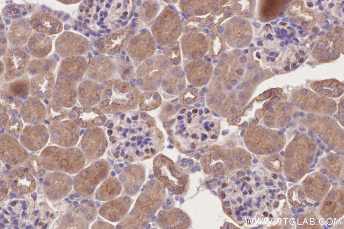 Immunohistochemical analysis of paraffin-embedded mouse kidney tissue slide using KHC2737 (BTN2A2 IHC Kit).