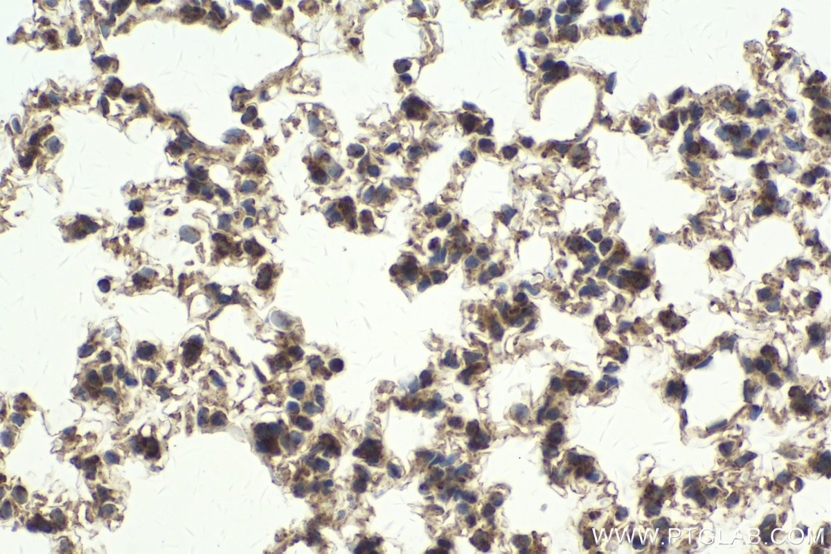 Immunohistochemical analysis of paraffin-embedded mouse lung tissue slide using KHC2013 (BTRC IHC Kit).