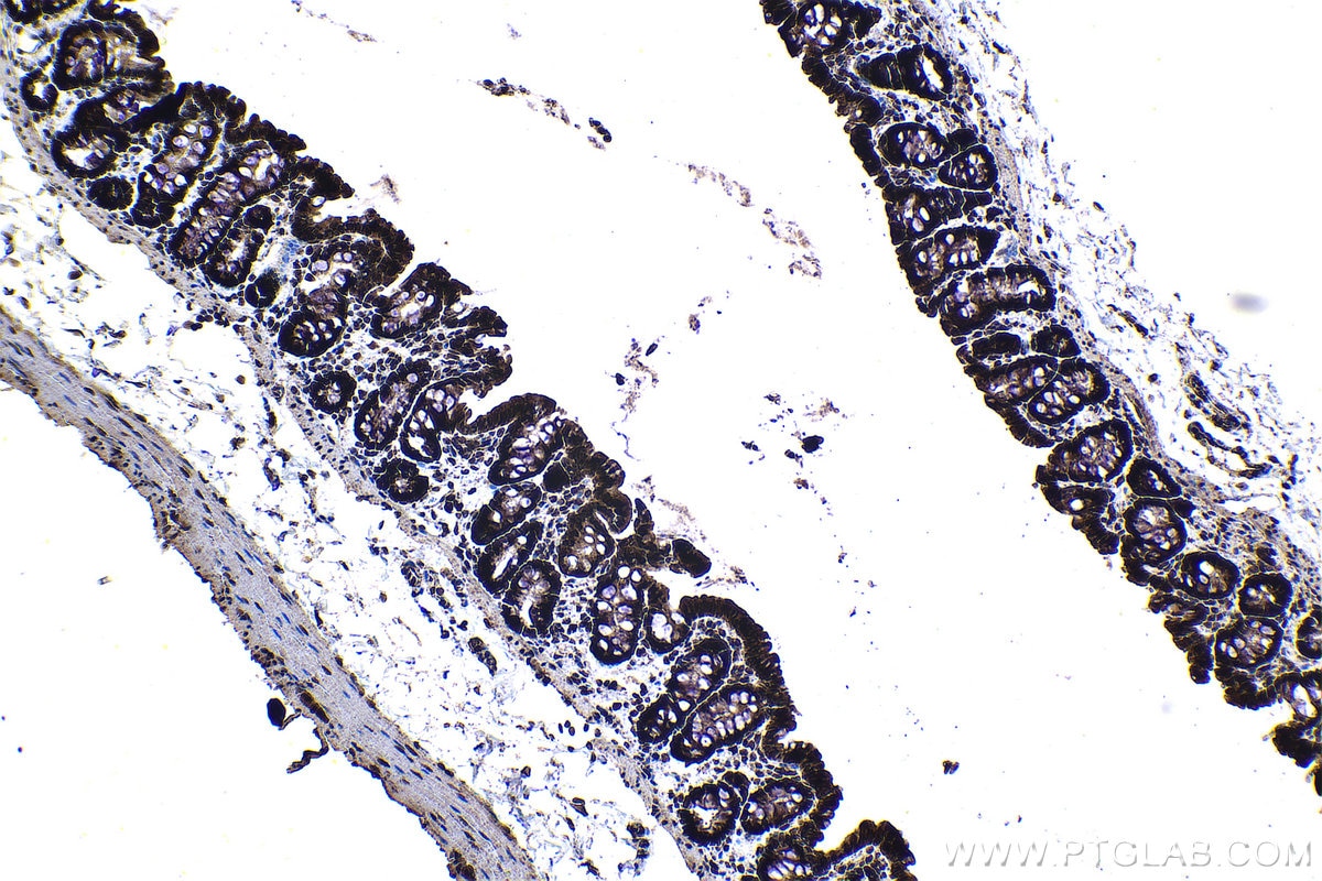 Immunohistochemical analysis of paraffin-embedded rat colon tissue slide using KHC1358 (BYSL IHC Kit).