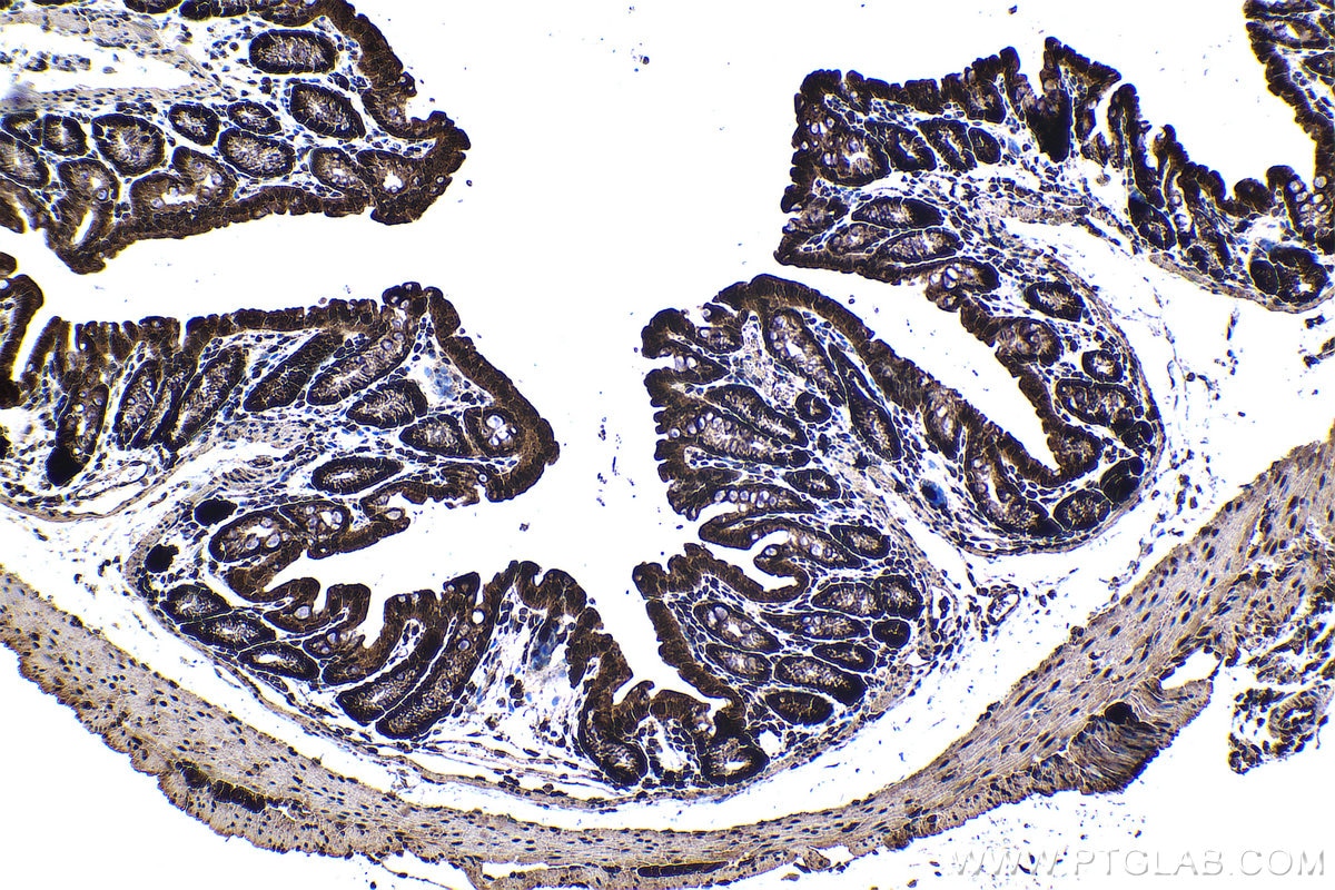 Immunohistochemical analysis of paraffin-embedded mouse colon tissue slide using KHC1358 (BYSL IHC Kit).