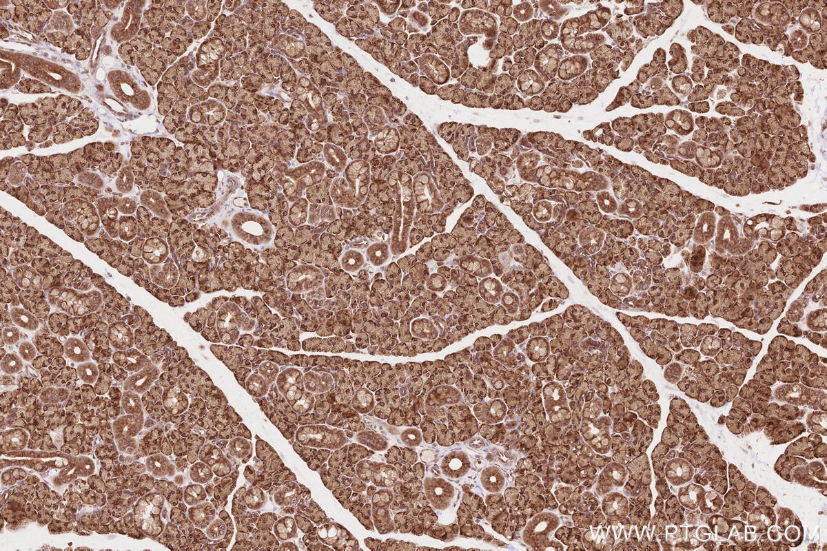 Immunohistochemical analysis of paraffin-embedded rat salivary gland tissue slide using KHC2612 (BZW1 IHC Kit).