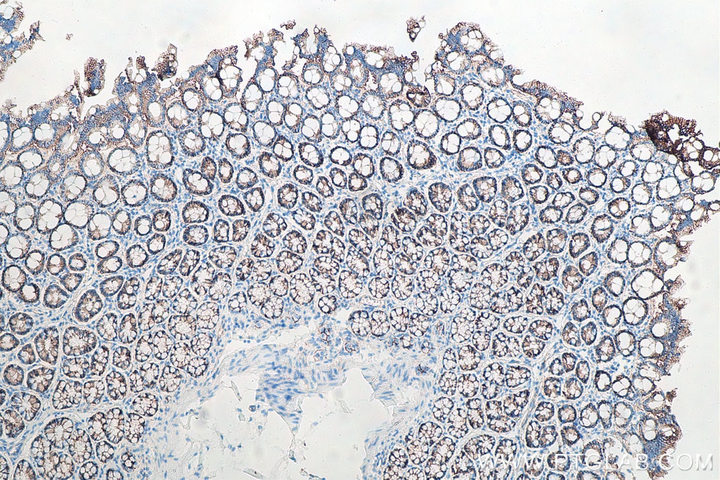 Immunohistochemical analysis of paraffin-embedded rat colon tissue slide using KHC0008 (Beta Catenin IHC Kit)