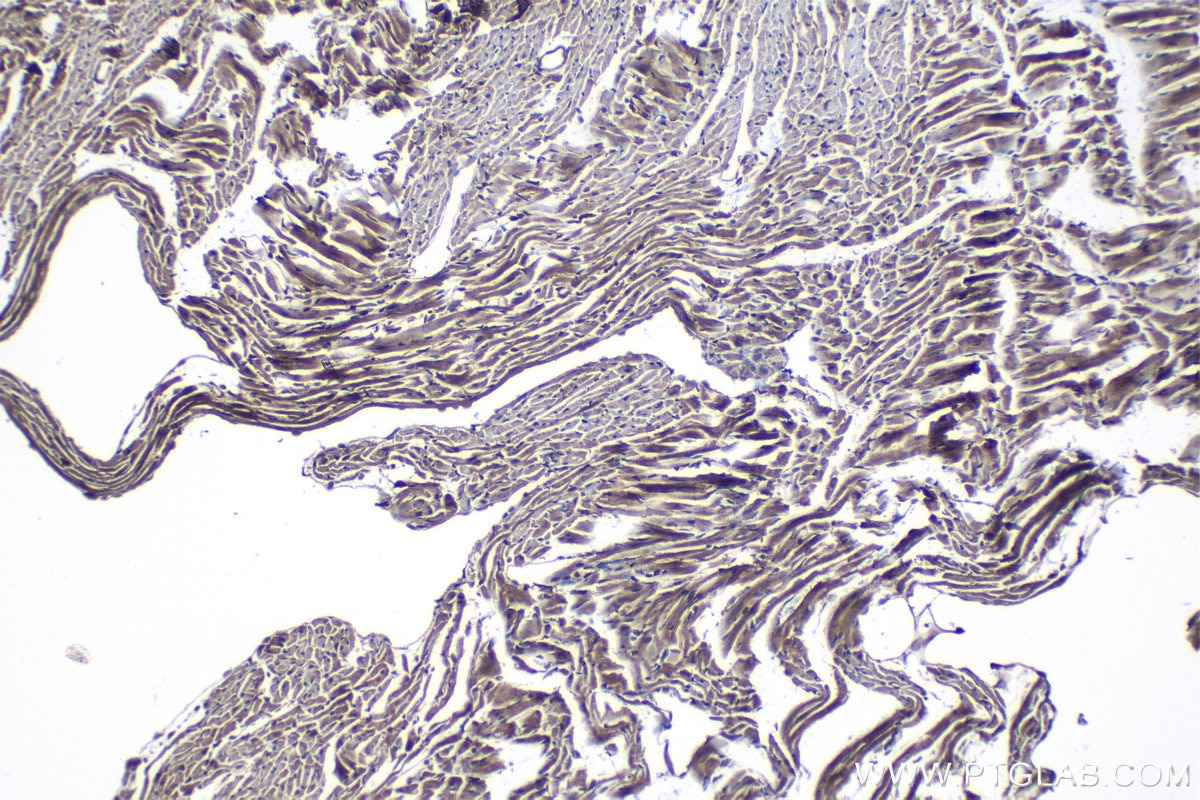 Immunohistochemical analysis of paraffin-embedded mouse heart tissue slide using KHC1196 (Bif-1 IHC Kit).
