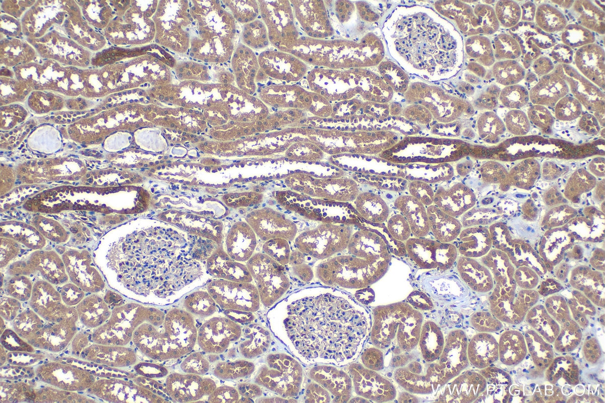 Immunohistochemical analysis of paraffin-embedded human kidney tissue slide using KHC1196 (Bif-1 IHC Kit).