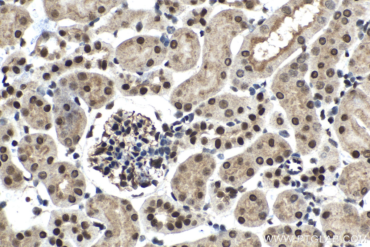 Immunohistochemical analysis of paraffin-embedded mouse kidney tissue slide using KHC1412 (C17orf49 IHC Kit).