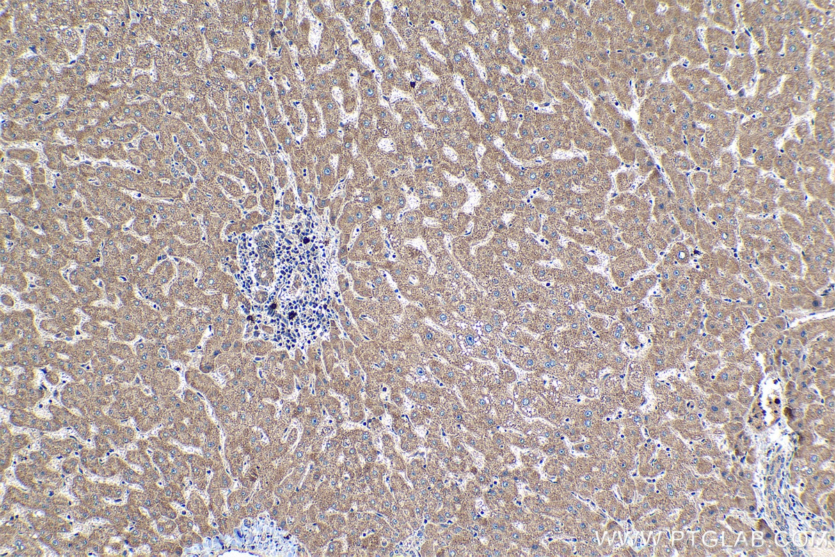 Immunohistochemical analysis of paraffin-embedded human liver tissue slide using KHC1295 (C18orf21 IHC Kit).