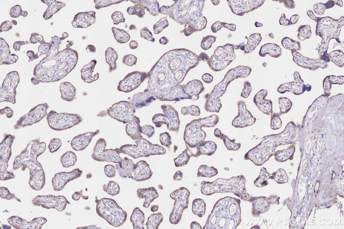 Immunohistochemical analysis of paraffin-embedded human placenta tissue slide using KHC3264 (C19orf63 IHC Kit).