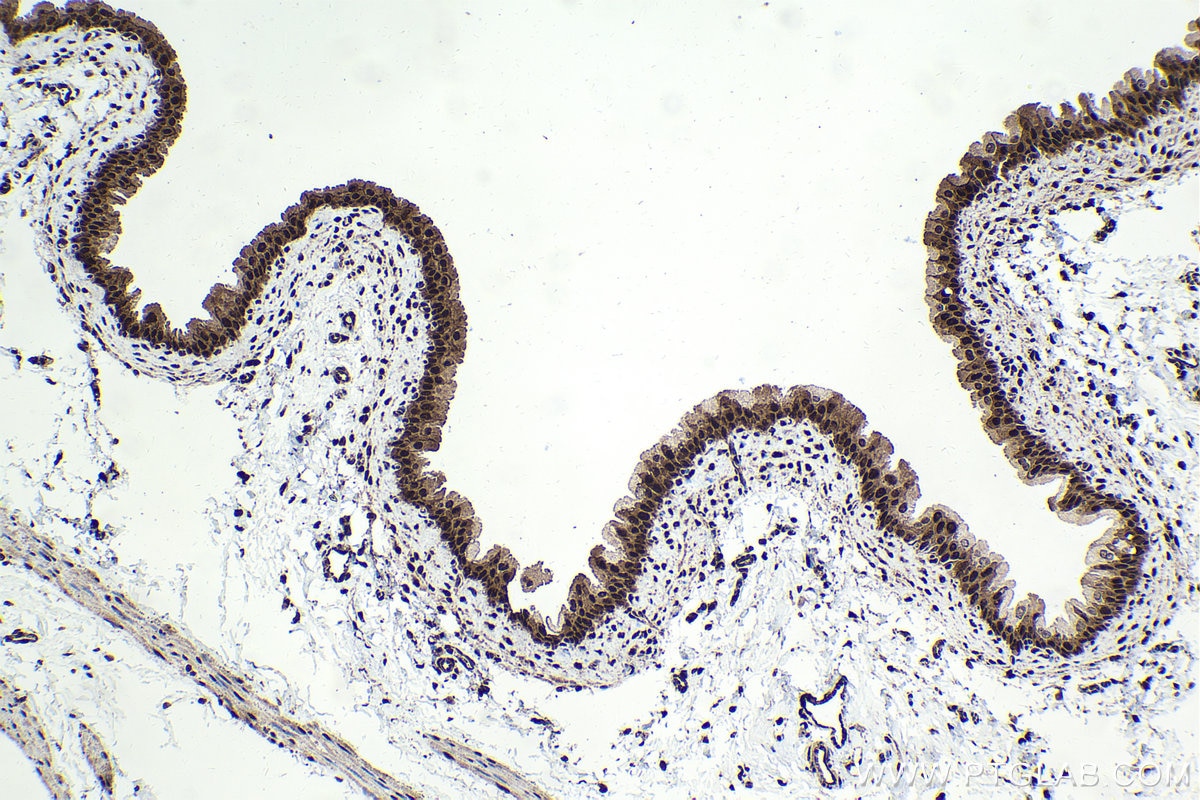 Immunohistochemical analysis of paraffin-embedded rat bladder tissue slide using KHC1722 (C1D IHC Kit).