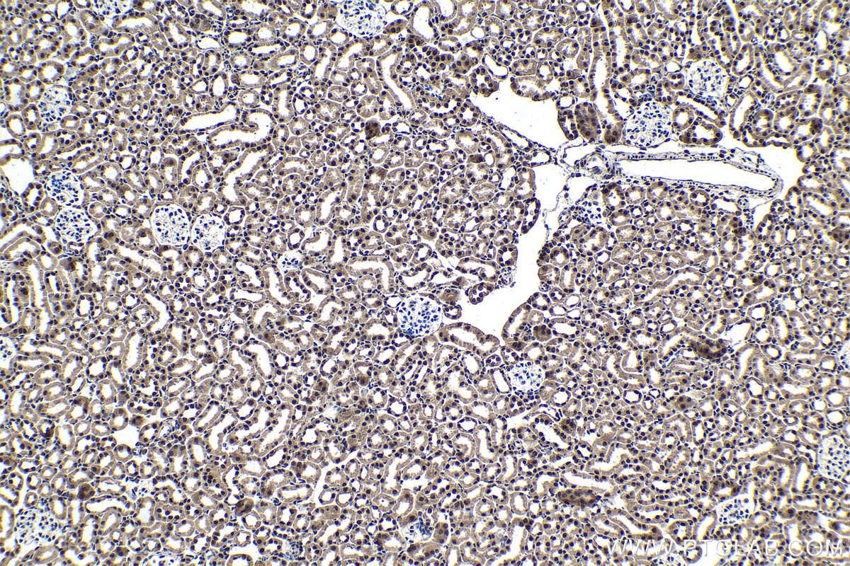 Immunohistochemical analysis of paraffin-embedded mouse kidney tissue slide using KHC1722 (C1D IHC Kit).