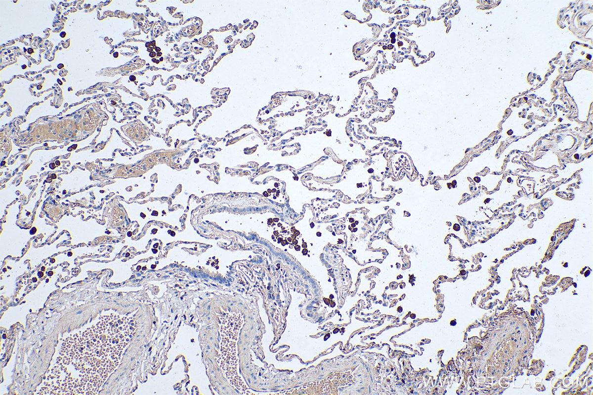 Immunohistochemical analysis of paraffin-embedded human lung tissue slide using KHC0479 (C1QA IHC Kit).