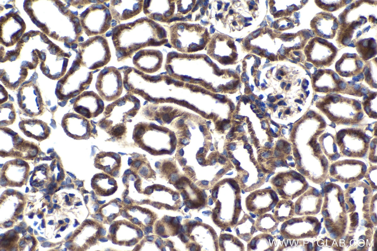 Immunohistochemical analysis of paraffin-embedded mouse kidney tissue slide using KHC1683 (C1QBP IHC Kit).