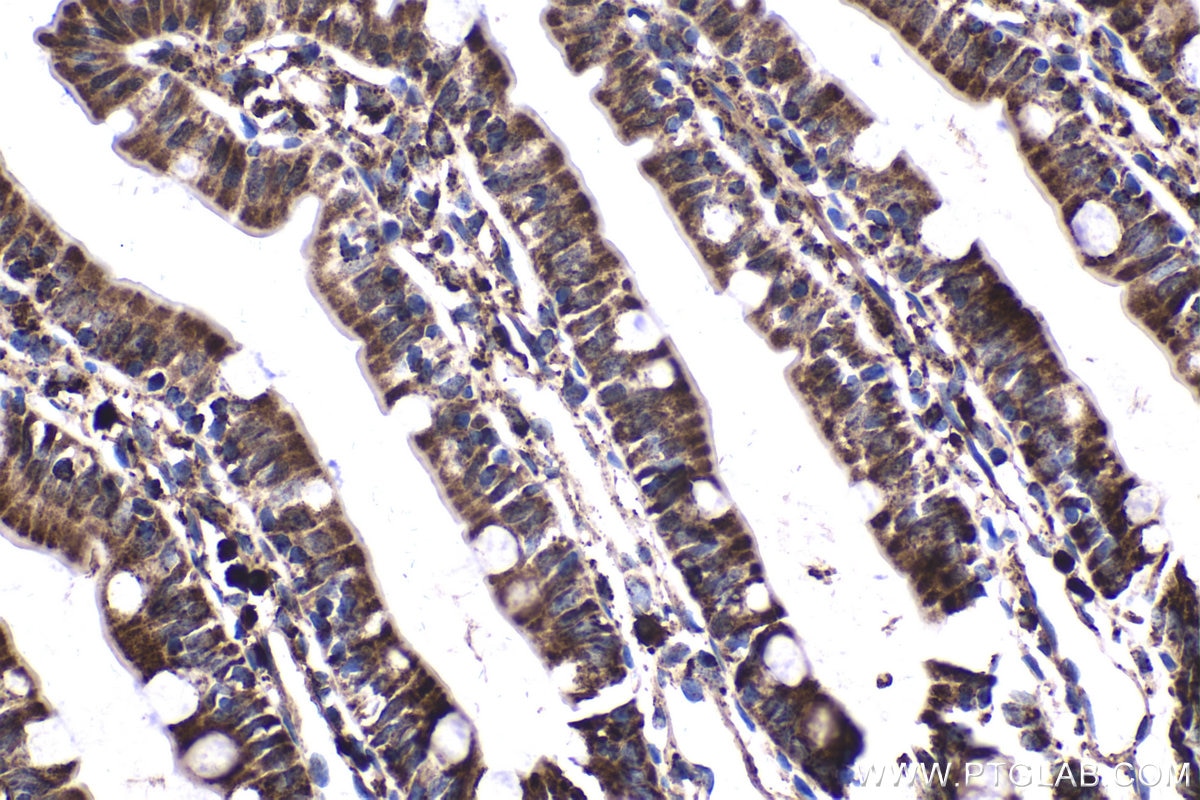 Immunohistochemical analysis of paraffin-embedded rat small intestine tissue slide using KHC1683 (C1QBP IHC Kit).