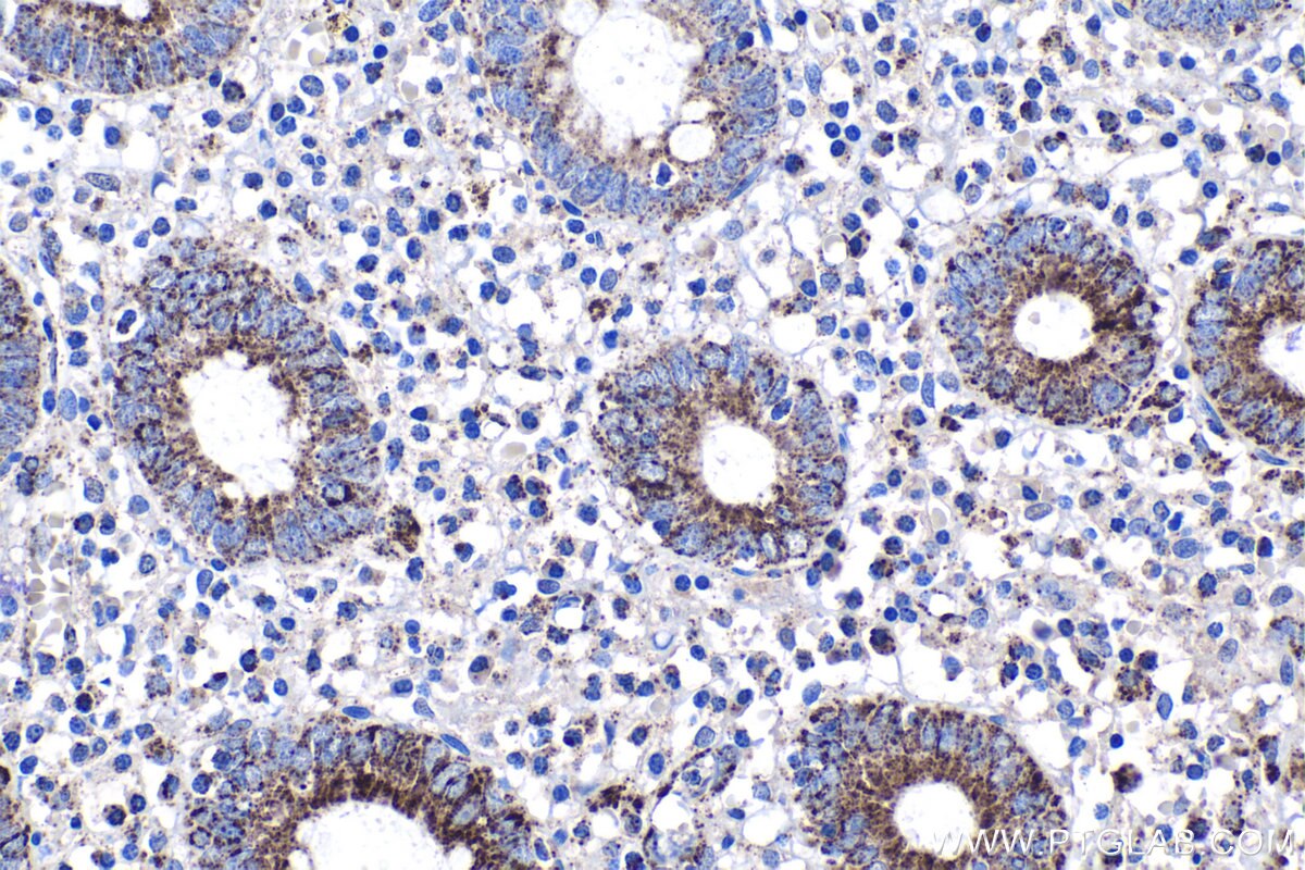 Immunohistochemical analysis of paraffin-embedded human appendicitis tissue slide using KHC1683 (C1QBP IHC Kit).