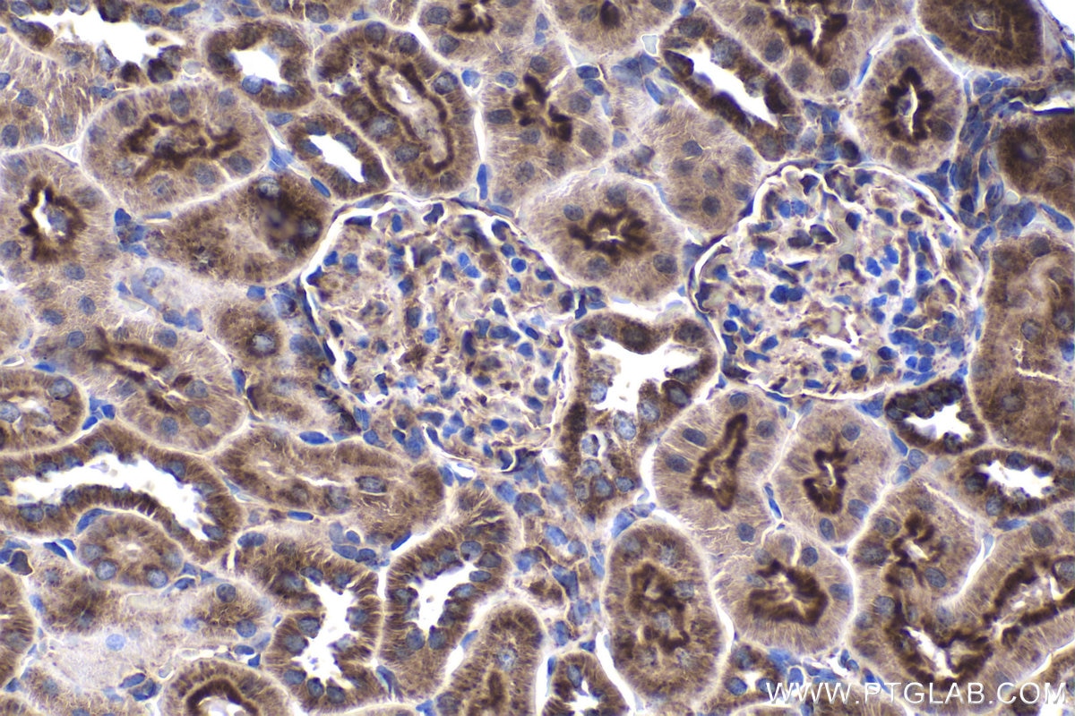 Immunohistochemical analysis of paraffin-embedded rat kidney tissue slide using KHC1683 (C1QBP IHC Kit).