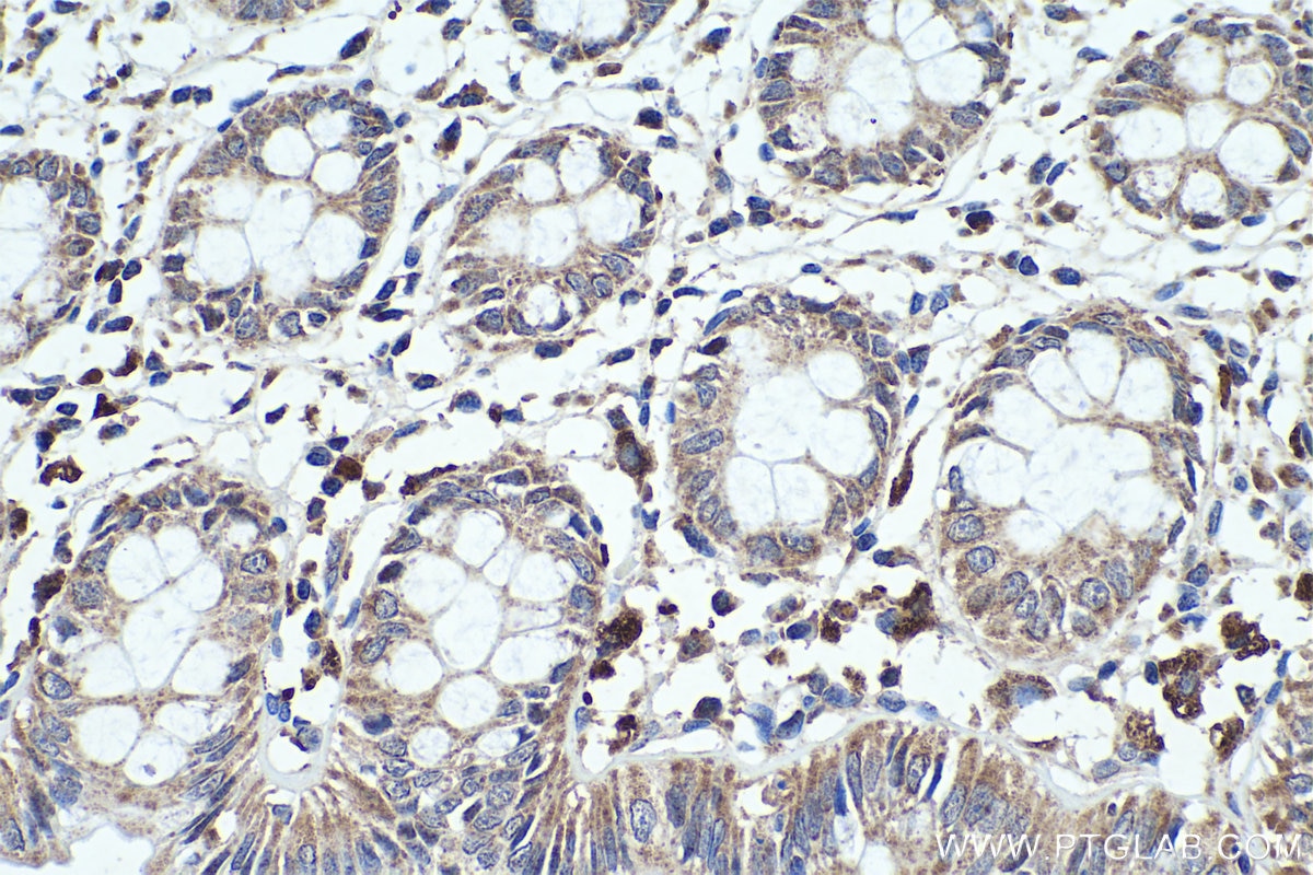 Immunohistochemical analysis of paraffin-embedded human colon tissue slide using KHC0372 (C1QC IHC Kit).