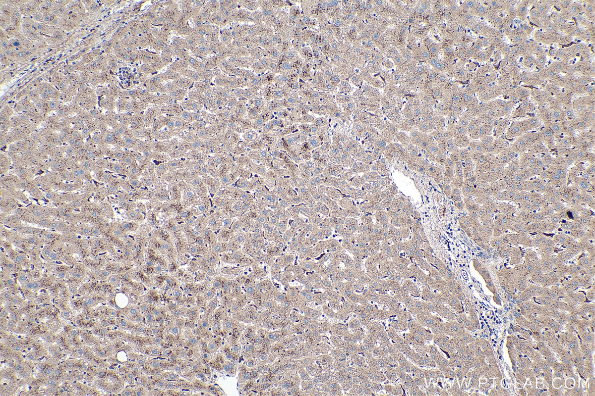 Immunohistochemical analysis of paraffin-embedded human liver tissue slide using KHC0372 (C1QC IHC Kit).