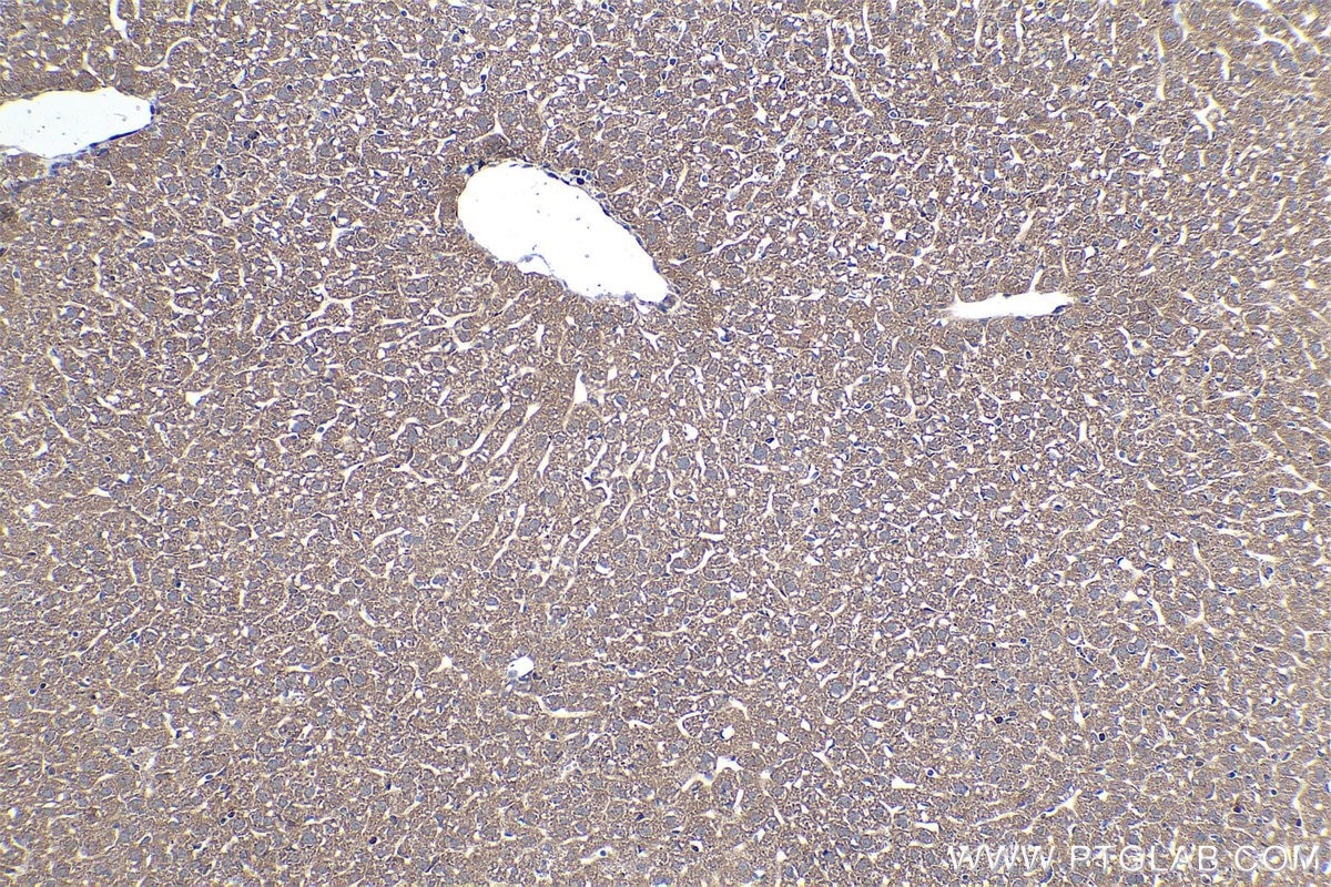 Immunohistochemical analysis of paraffin-embedded mouse liver tissue slide using KHC0372 (C1QC IHC Kit).