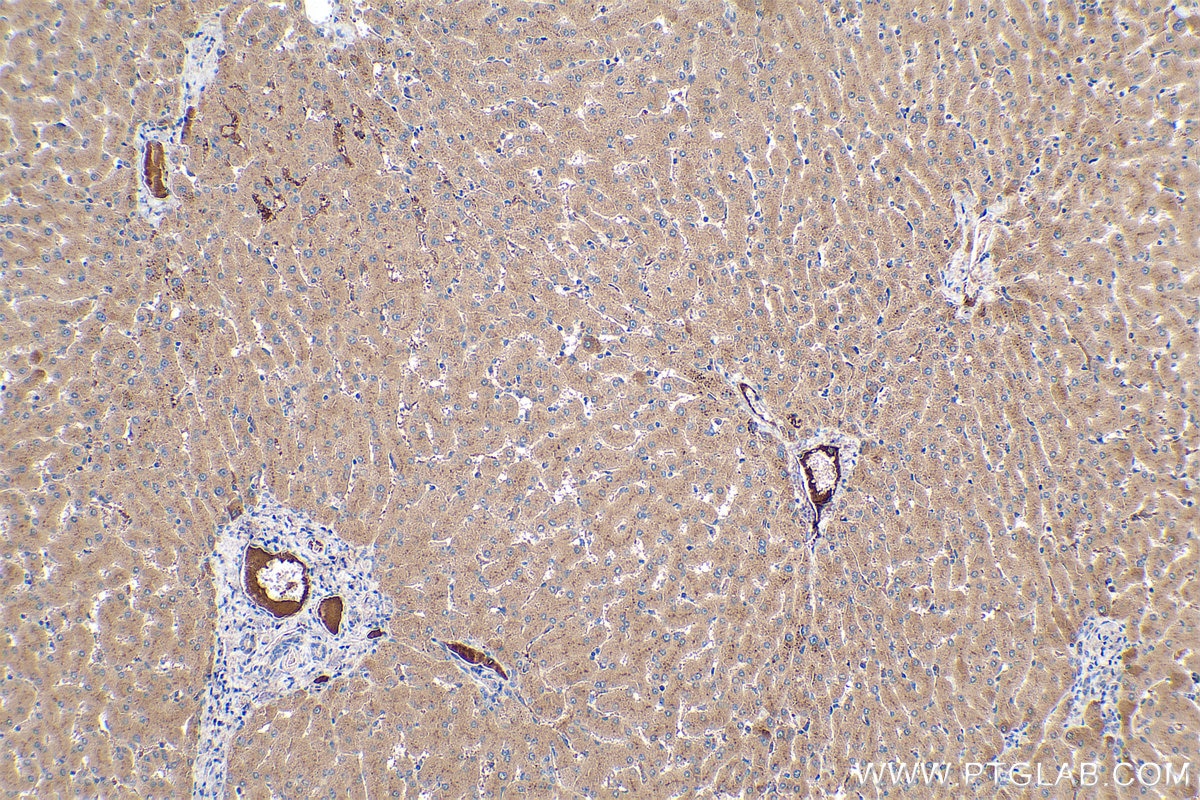 Immunohistochemical analysis of paraffin-embedded human liver tissue slide using KHC0404 (C1R IHC Kit).