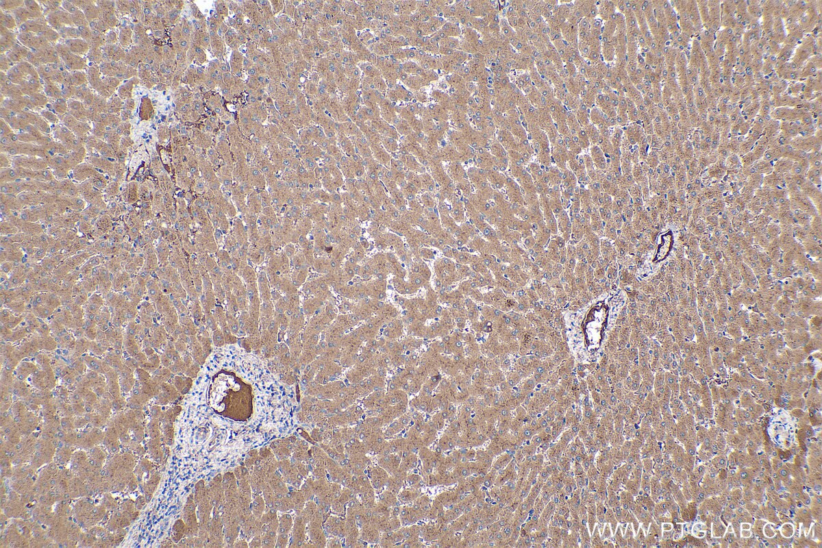 Immunohistochemical analysis of paraffin-embedded human liver tissue slide using KHC0405 (C1S IHC Kit).