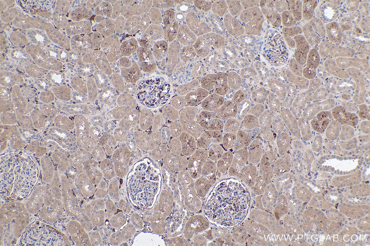 Immunohistochemical analysis of paraffin-embedded human kidney tissue slide using KHC0405 (C1S IHC Kit).